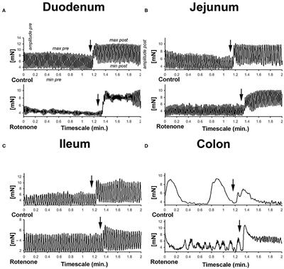 Pathophysiological Changes in the Enteric Nervous System of Rotenone-Exposed Mice as Early Radiological Markers for Parkinson's Disease